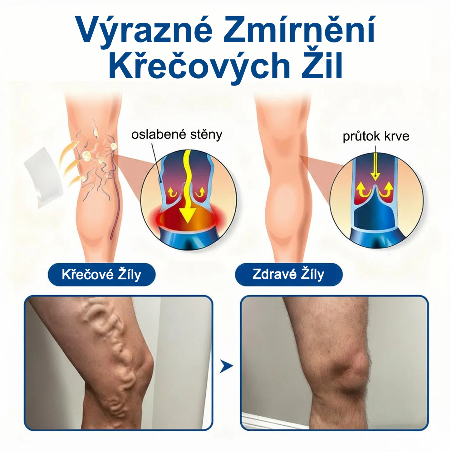 FLORISMA® plaster mikroigłowy z diosminą i hesperydyną o formule klasy klinicznej🌿 — ukierunkowany na żylaki i pajączki naczyniowe, łagodzi uczucie ciężkich i zmęczonych nóg