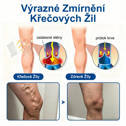 FLORISMA® plaster mikroigłowy z diosminą i hesperydyną o formule klasy klinicznej🌿 — ukierunkowany na żylaki i pajączki naczyniowe, łagodzi uczucie ciężkich i zmęczonych nóg