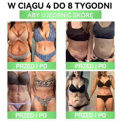 Oficjalny Sklep | 🇵🇱 𝐆𝐞𝐞𝐥𝐞𝐦𝐨𝐧® Glumasetide 8 w 1 Smukły i Zdrowy Nano Plaster z Mikronakłuciami ✅ Na otyłość, wiotką skórę, cukrzycę, bezdech senny, problemy ze stawami i wiele więcej