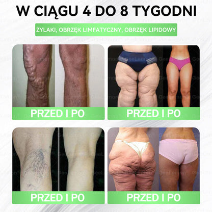 Oficjalny Sklep | 🇵🇱 𝐆𝐞𝐞𝐥𝐞𝐦𝐨𝐧® Glumasetide 8 w 1 Smukły i Zdrowy Nano Plaster z Mikronakłuciami ✅ Na otyłość, wiotką skórę, cukrzycę, bezdech senny, problemy ze stawami i wiele więcej
