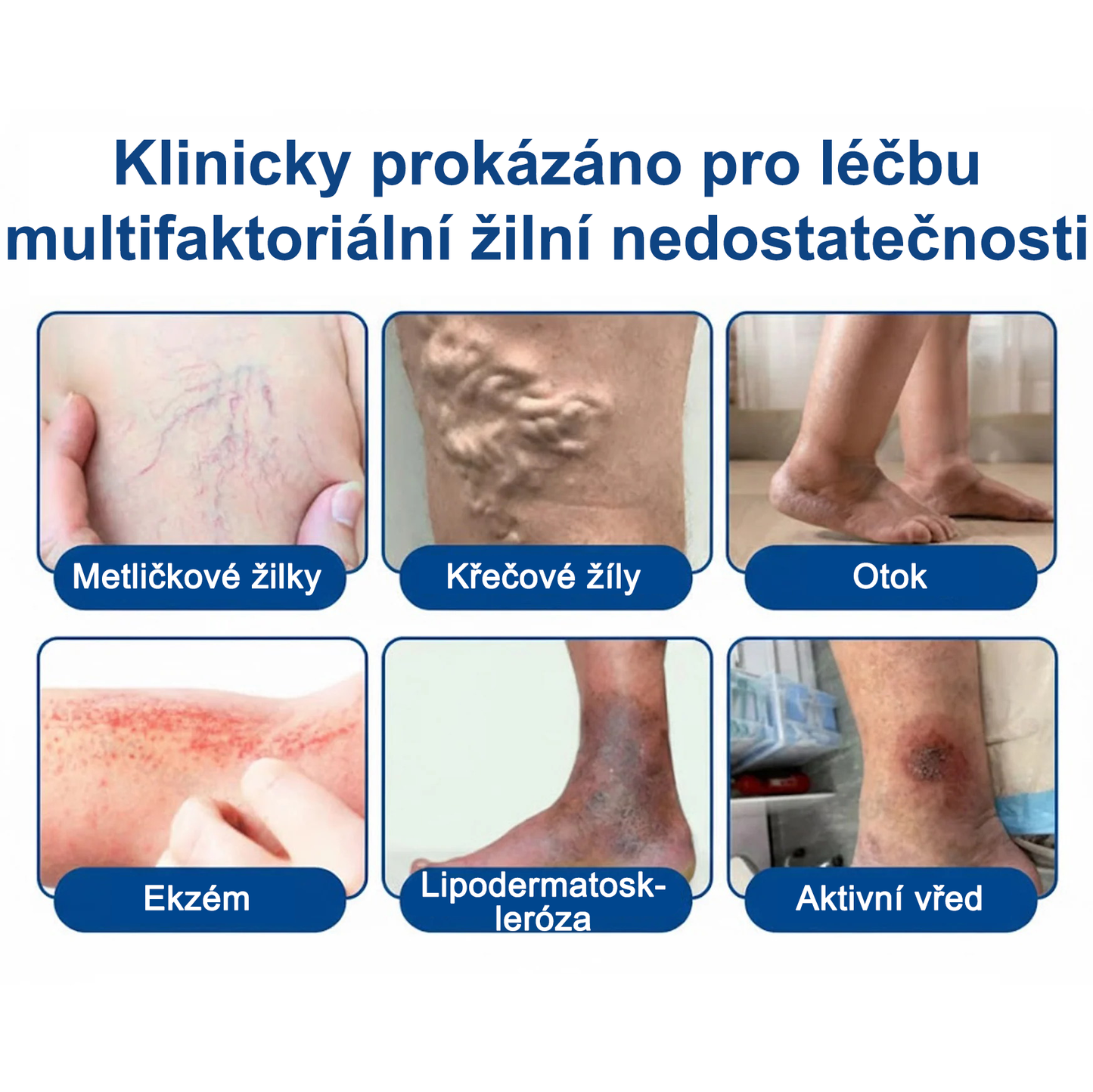 FLORISMA® plaster mikroigłowy z diosminą i hesperydyną o formule klasy klinicznej🌿 — ukierunkowany na żylaki i pajączki naczyniowe, łagodzi uczucie ciężkich i zmęczonych nóg