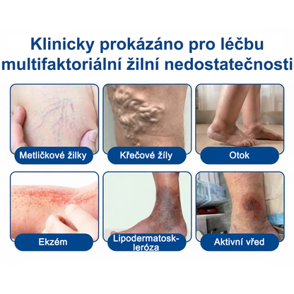 FLORISMA® plaster mikroigłowy z diosminą i hesperydyną o formule klasy klinicznej🌿 — ukierunkowany na żylaki i pajączki naczyniowe, łagodzi uczucie ciężkich i zmęczonych nóg