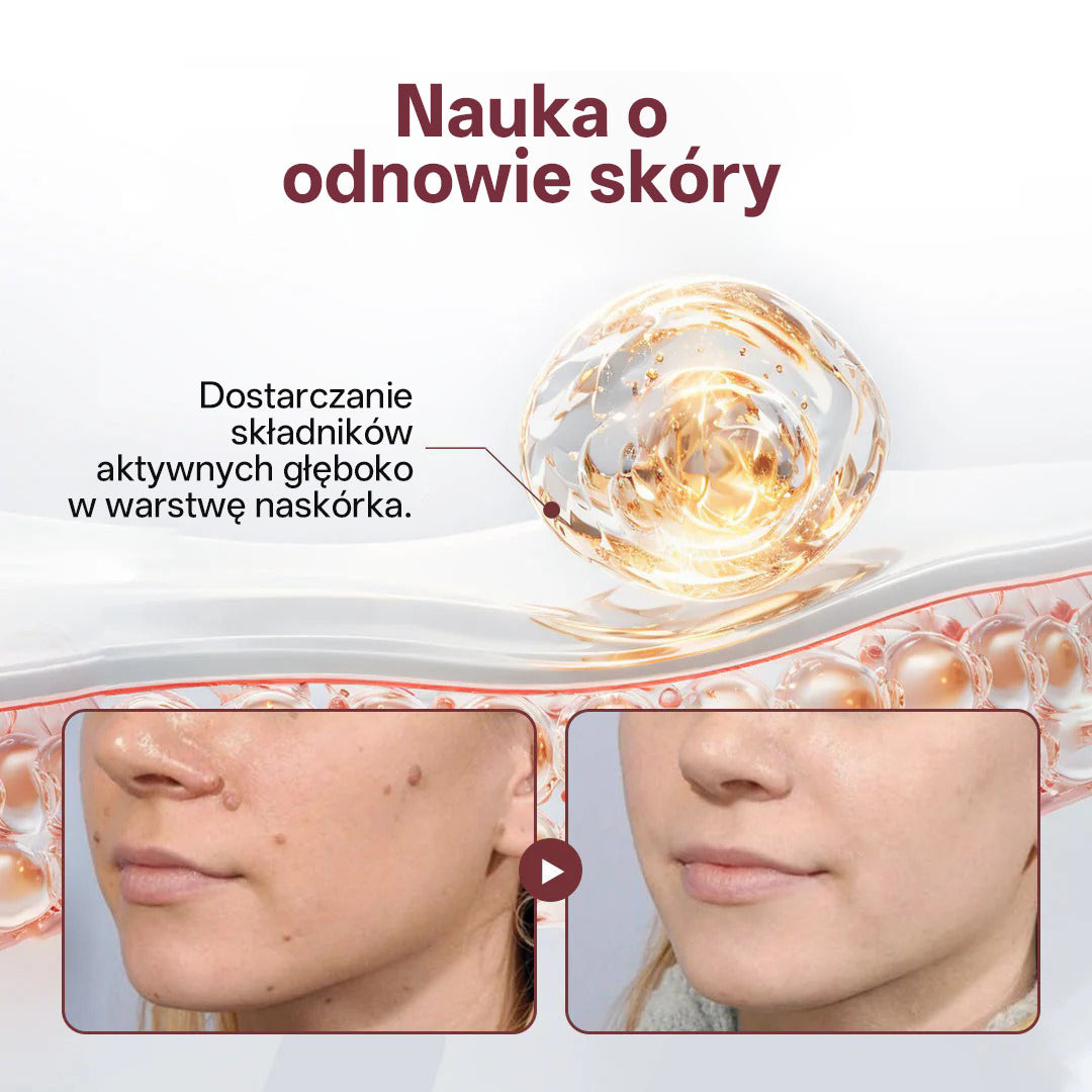 💎 Biancat® KeraErase Dwukierunkowy Krem Regenerujący 👨‍⚕️ (do leczenia brodawek, narośli skórnych, plam oraz hiperpigmentacji)