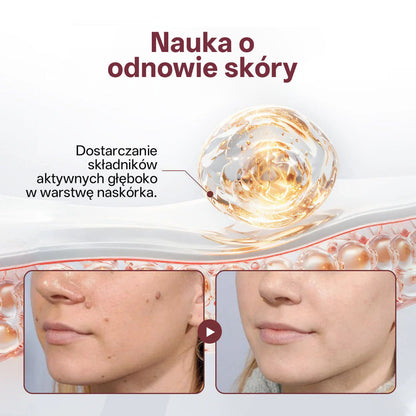 💎 Biancat® KeraErase Dwukierunkowy Krem Regenerujący 👨‍⚕️ (do leczenia brodawek, narośli skórnych, plam oraz hiperpigmentacji)