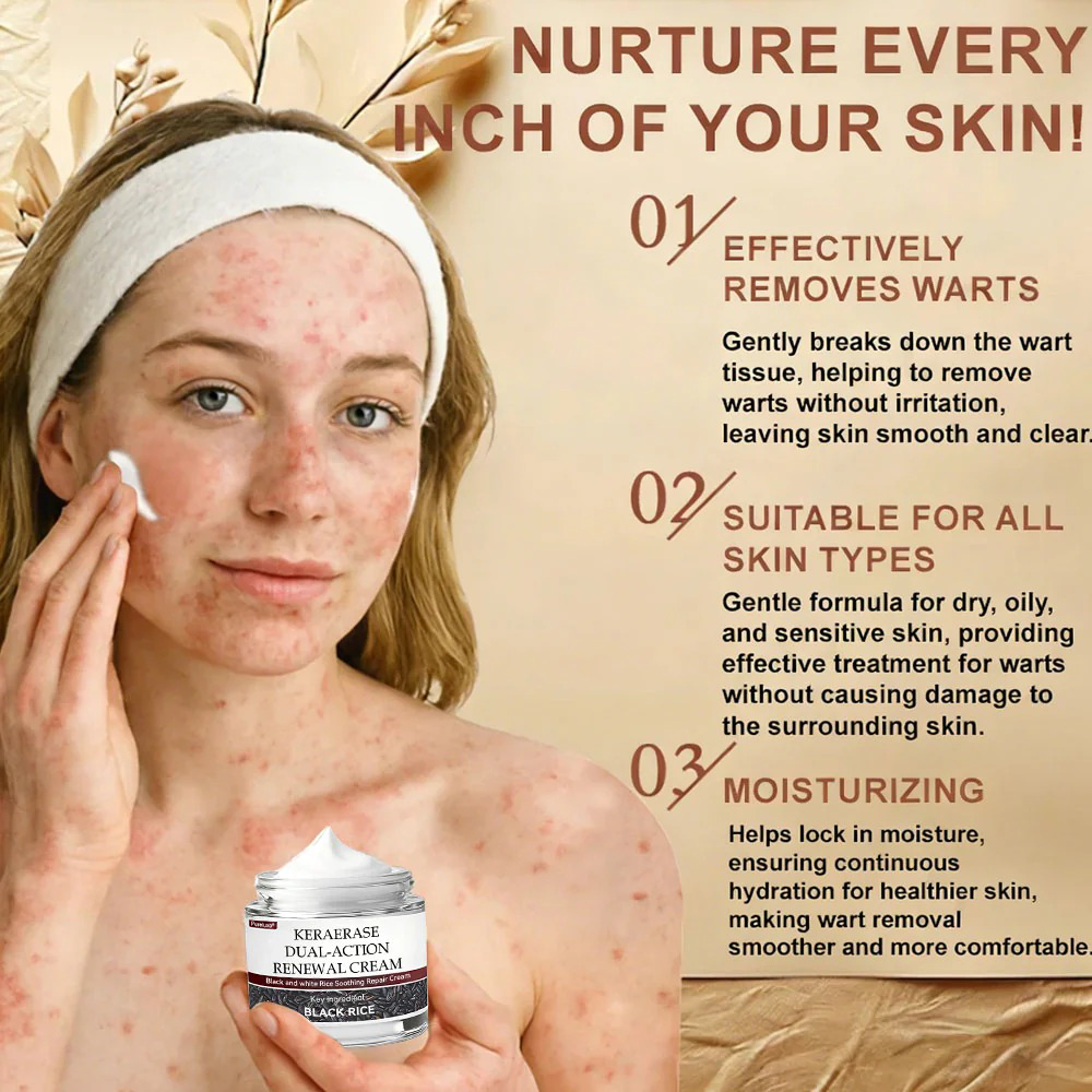 Pureluxo® KeraErase Dual-Action Renewal Cream 🌟(removes warts and skin growths, senile purpura)