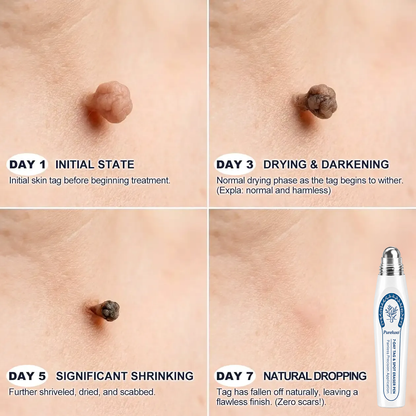 Pureluxo® 🌟7-Day Tag & Spot Eraser (Zero Pain, Zero Scars Rollerball)