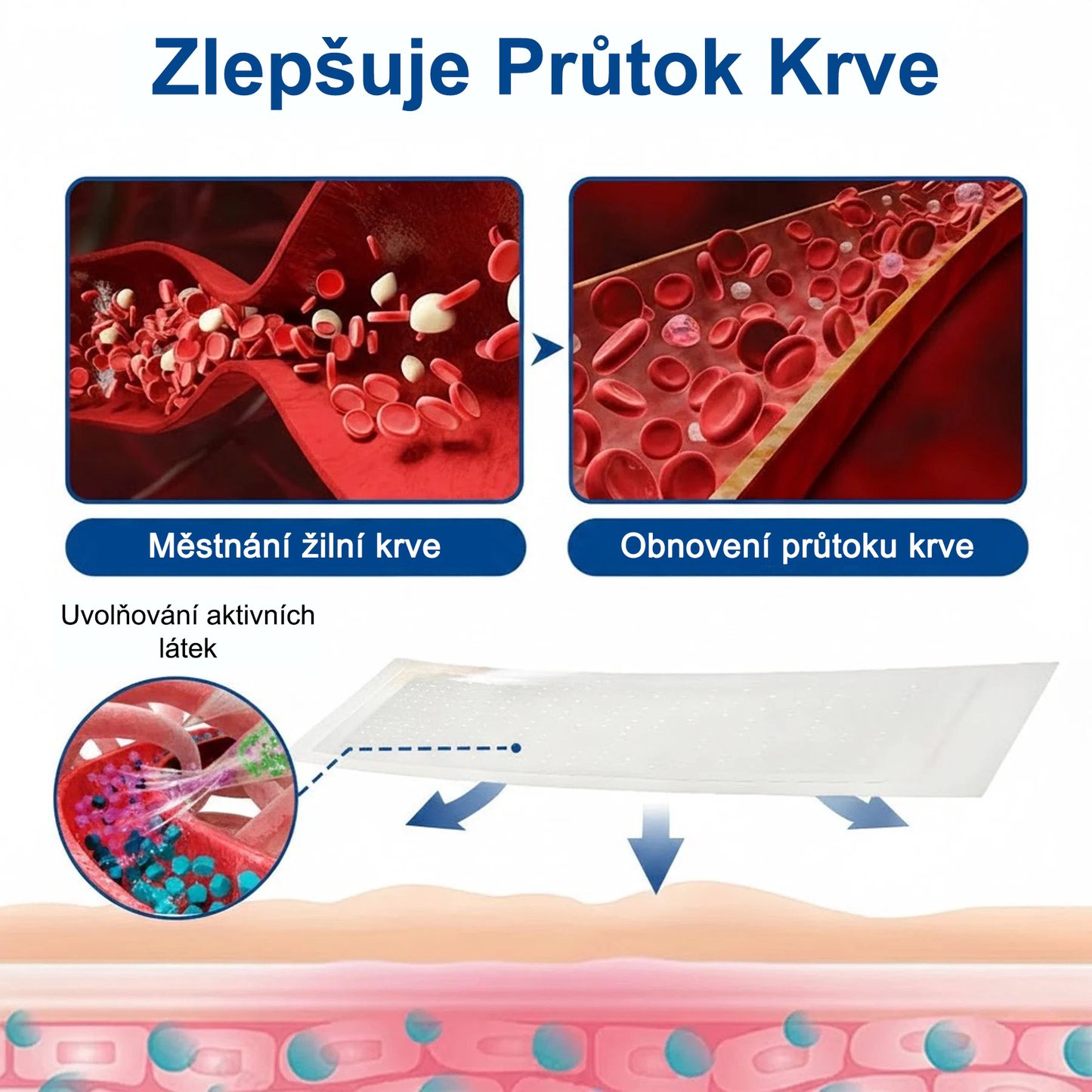 FLORISMA® plaster mikroigłowy z diosminą i hesperydyną o formule klasy klinicznej🌿 — ukierunkowany na żylaki i pajączki naczyniowe, łagodzi uczucie ciężkich i zmęczonych nóg