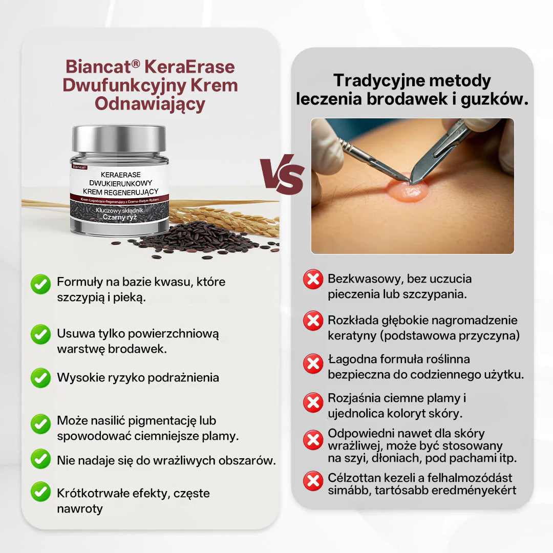 💎 Biancat® KeraErase Dwukierunkowy Krem Regenerujący 👨‍⚕️ (do leczenia brodawek, narośli skórnych, plam oraz hiperpigmentacji)